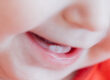 Why Baby Teeth Deserve a Conservative and Holistic Treatment Plan