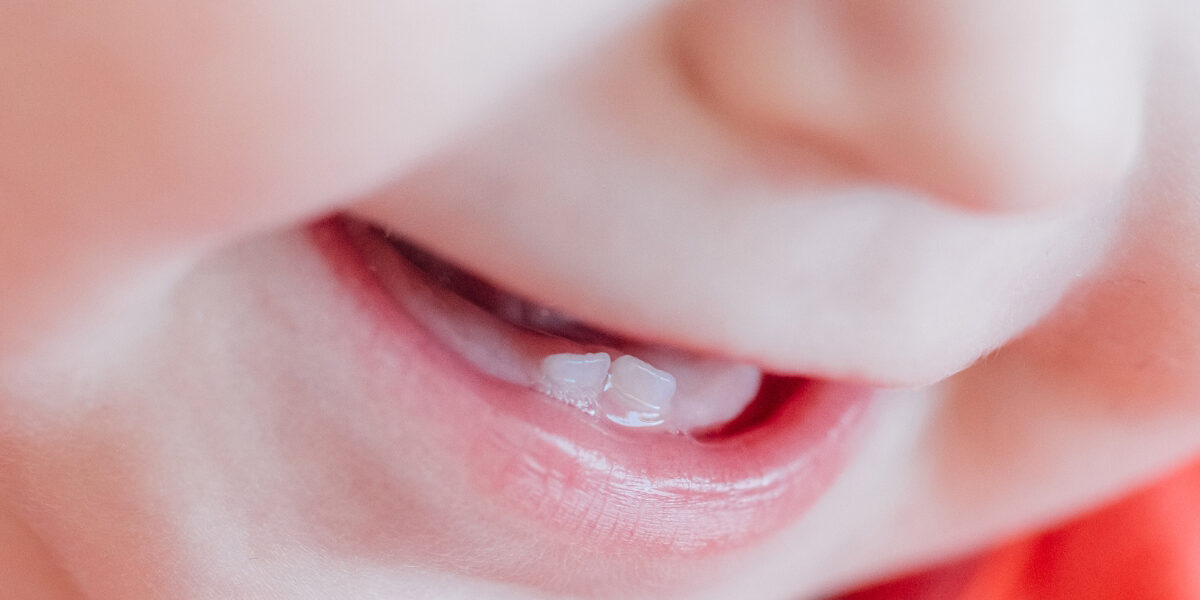 Why Baby Teeth Deserve a Conservative and Holistic Treatment Plan Why Baby Teeth Deserve a Conservative and Holistic Treatment Plan