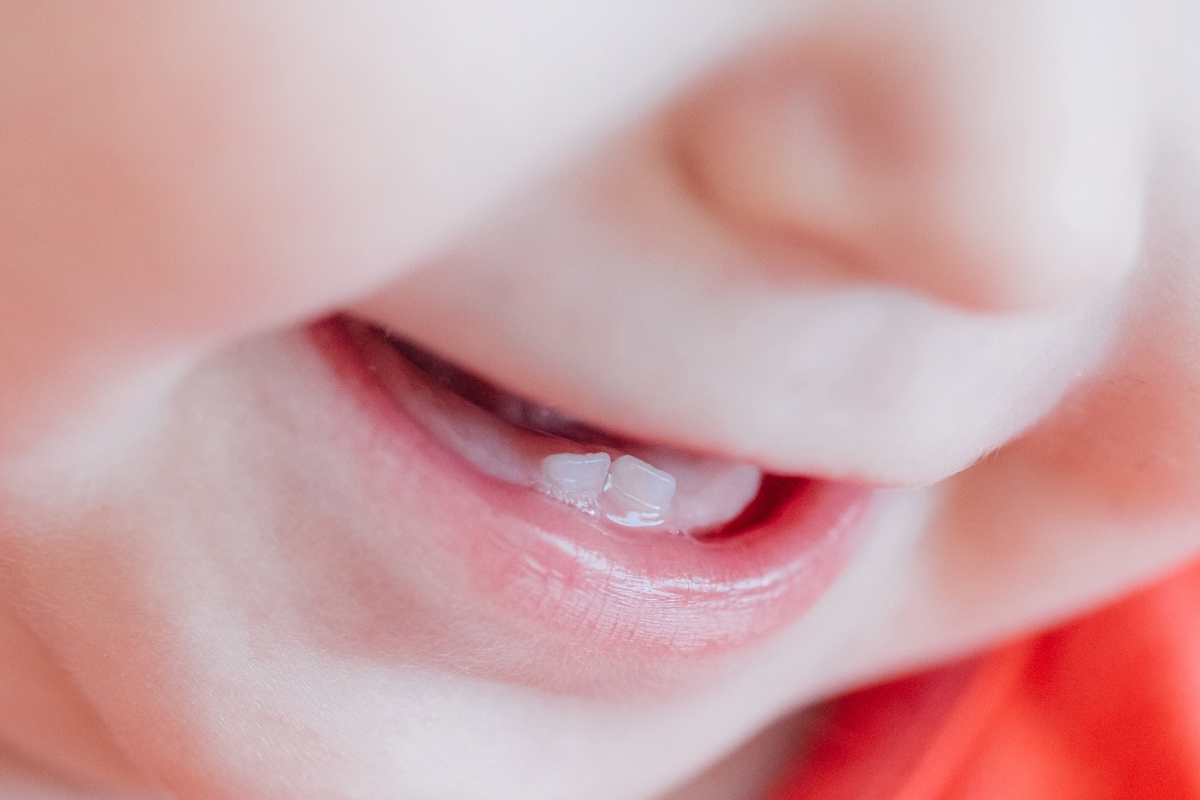 Why Baby Teeth Deserve a Conservative and Holistic Treatment Plan Why Baby Teeth Deserve a Conservative and Holistic Treatment Plan